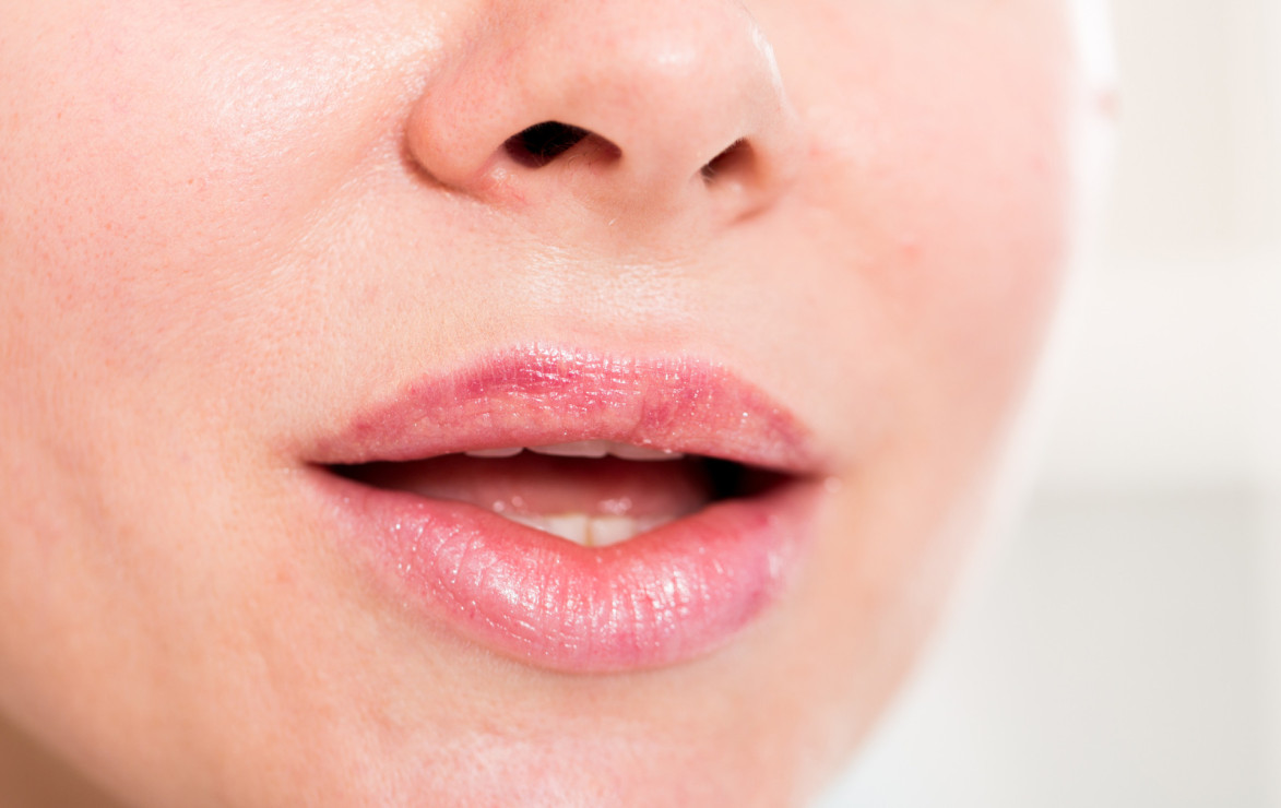 Wat te doen tegen lipblaasjes? - Beautyspecialisten in vlaanderen